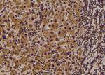 Phospho-RHOA (Thr100) Antibody in Immunohistochemistry (Paraffin) (IHC (P))