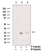 Phospho-RHOA (Thr100) Antibody in Western Blot (WB)