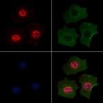 Phospho-MEF2A (Ser479) Antibody in Immunocytochemistry (ICC/IF)