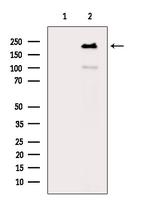 Phospho-EIF4G1 (Ser1147) Antibody in Western Blot (WB)
