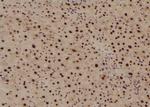 Phospho-EIF4G1 (Ser1185) Antibody in Immunohistochemistry (Paraffin) (IHC (P))