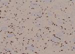 Phospho-EIF4G1 (Ser1185) Antibody in Immunohistochemistry (Paraffin) (IHC (P))