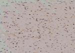 Phospho-EIF4G1 (Ser1185) Antibody in Immunohistochemistry (Paraffin) (IHC (P))