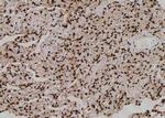 Phospho-ACK1 (Tyr284) Antibody in Immunohistochemistry (Paraffin) (IHC (P))