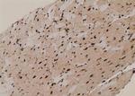 Phospho-ACK1 (Tyr284) Antibody in Immunohistochemistry (Paraffin) (IHC (P))