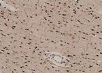 Phospho-ACK1 (Tyr284) Antibody in Immunohistochemistry (Paraffin) (IHC (P))