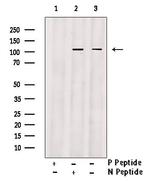 Phospho-ACK1 (Tyr284) Antibody in Western Blot (WB)