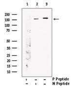 Phospho-NMDAR2A (Tyr943) Antibody in Western Blot (WB)
