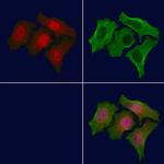 Phospho-Acetyl-CoA Carboxylase (Thr1196) Antibody in Immunocytochemistry (ICC/IF)