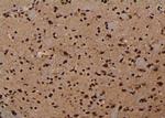 Phospho-NMDAR2B (Ser1303) Antibody in Immunohistochemistry (Paraffin) (IHC (P))