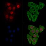 Phospho-SKP2 (Thr417) Antibody in Immunocytochemistry (ICC/IF)