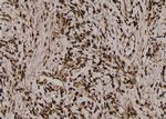 Phospho-4EBP1 (Thr45) Antibody in Immunohistochemistry (Paraffin) (IHC (P))