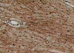 Phospho-4EBP1 (Thr45) Antibody in Immunohistochemistry (Paraffin) (IHC (P))