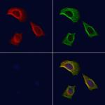 Phospho-RIP1 (Ser161) Antibody in Immunocytochemistry (ICC/IF)