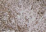 Phospho-RIP1 (Ser161) Antibody in Immunohistochemistry (Paraffin) (IHC (P))