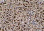 Phospho-RIP1 (Ser161) Antibody in Immunohistochemistry (Paraffin) (IHC (P))