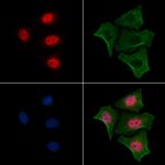 Phospho-RUNX2 (Ser28) Antibody in Immunocytochemistry (ICC/IF)