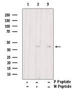 Phospho-CaMKI (Thr177) Antibody in Western Blot (WB)