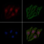 Phospho-IRF3 (Ser14) Antibody in Immunocytochemistry (ICC/IF)