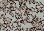 Phospho-IRF3 (Ser14) Antibody in Immunohistochemistry (Paraffin) (IHC (P))