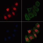 Phospho-NCOA2 (Ser698, Ser699) Antibody in Immunocytochemistry (ICC/IF)