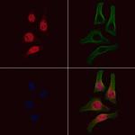 Phospho-EZH2 (Thr487) Antibody in Immunocytochemistry (ICC/IF)