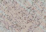 Phospho-Zyxin (Tyr316) Antibody in Immunohistochemistry (Paraffin) (IHC (P))