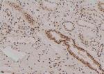 Phospho-Zyxin (Tyr316) Antibody in Immunohistochemistry (Paraffin) (IHC (P))