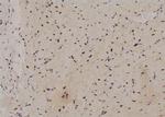 Phospho-Zyxin (Tyr316) Antibody in Immunohistochemistry (Paraffin) (IHC (P))