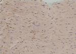 Phospho-Zyxin (Ser143) Antibody in Immunohistochemistry (Paraffin) (IHC (P))