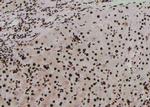 Phospho-PKN2 (Ser815) Antibody in Immunohistochemistry (Paraffin) (IHC (P))