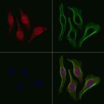 Phospho-TBC1D1 (Ser627) Antibody in Immunocytochemistry (ICC/IF)