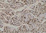 Phospho-TBC1D1 (Ser627) Antibody in Immunohistochemistry (Paraffin) (IHC (P))