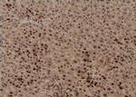 Phospho-TBC1D1 (Ser627) Antibody in Immunohistochemistry (Paraffin) (IHC (P))