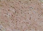 Phospho-TBC1D1 (Ser627) Antibody in Immunohistochemistry (Paraffin) (IHC (P))