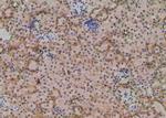 Phospho-RICTOR (Ser1591) Antibody in Immunohistochemistry (Paraffin) (IHC (P))