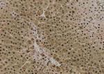 Phospho-RICTOR (Ser1591) Antibody in Immunohistochemistry (Paraffin) (IHC (P))