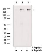 Phospho-RICTOR (Ser1591) Antibody in Western Blot (WB)