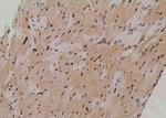 Phospho-ATG14 (Thr429) Antibody in Immunohistochemistry (Paraffin) (IHC (P))