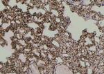 Phospho-MLKL (Ser125) Antibody in Immunohistochemistry (Paraffin) (IHC (P))