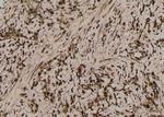 Phospho-MLKL (Ser358) Antibody in Immunohistochemistry (Paraffin) (IHC (P))