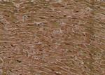 Phospho-MLKL (Ser358) Antibody in Immunohistochemistry (Paraffin) (IHC (P))