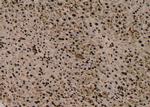 Phospho-Bad (Ser75) Antibody in Immunohistochemistry (Paraffin) (IHC (P))