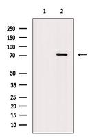 Phospho-PKMYT1 (Ser120) Antibody in Western Blot (WB)