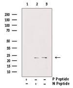 Phospho-LIN28A (Ser200) Antibody in Western Blot (WB)