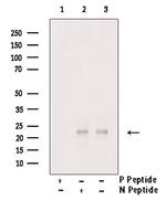 Phospho-TWIST1 (Ser68) Antibody in Western Blot (WB)