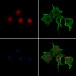 Phospho-TWIST1 (Ser68) Antibody in Immunocytochemistry (ICC/IF)