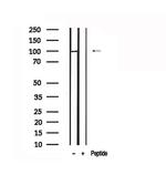 Phospho-TLR4 (Ser800) Antibody in Western Blot (WB)