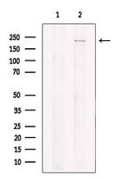 KIF1B Antibody in Western Blot (WB)