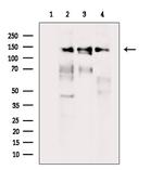 TBC1D1 Antibody in Western Blot (WB)